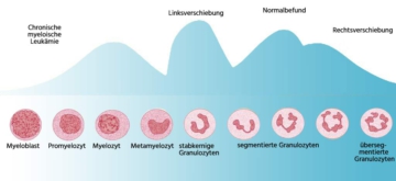 ᐅ Granulozyten: der Laborwert gehört zur Leukozytenfamilie