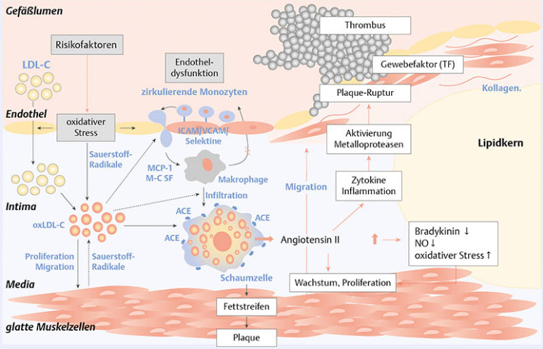 LDL-Cholesterin-Pathogenese