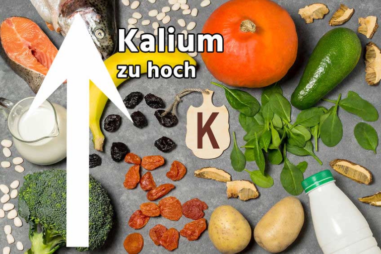 Kaliumwert Im Blut Zu Hoch www.laborwert.info