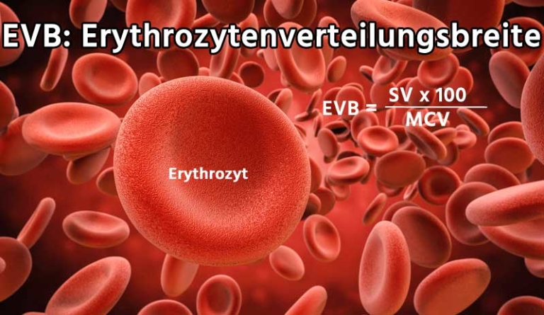 Evb Wert Blut