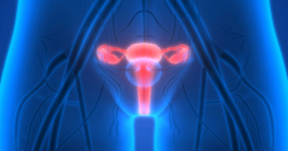 Endometriose frühzeitig erkennen